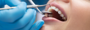 Read more about the article cosmetic dentistry hyderabad